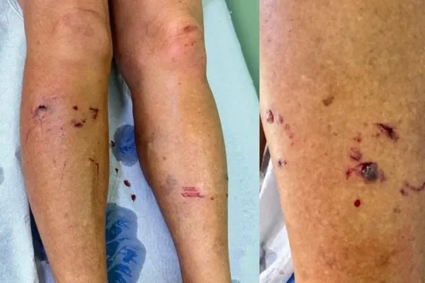 Uma mulher de 59 anos foi atacada por uma raposa enquanto caminhava na zona rural de Cruz das Almas, no Rec&ocirc;ncavo. | Foto: Redes Sociais