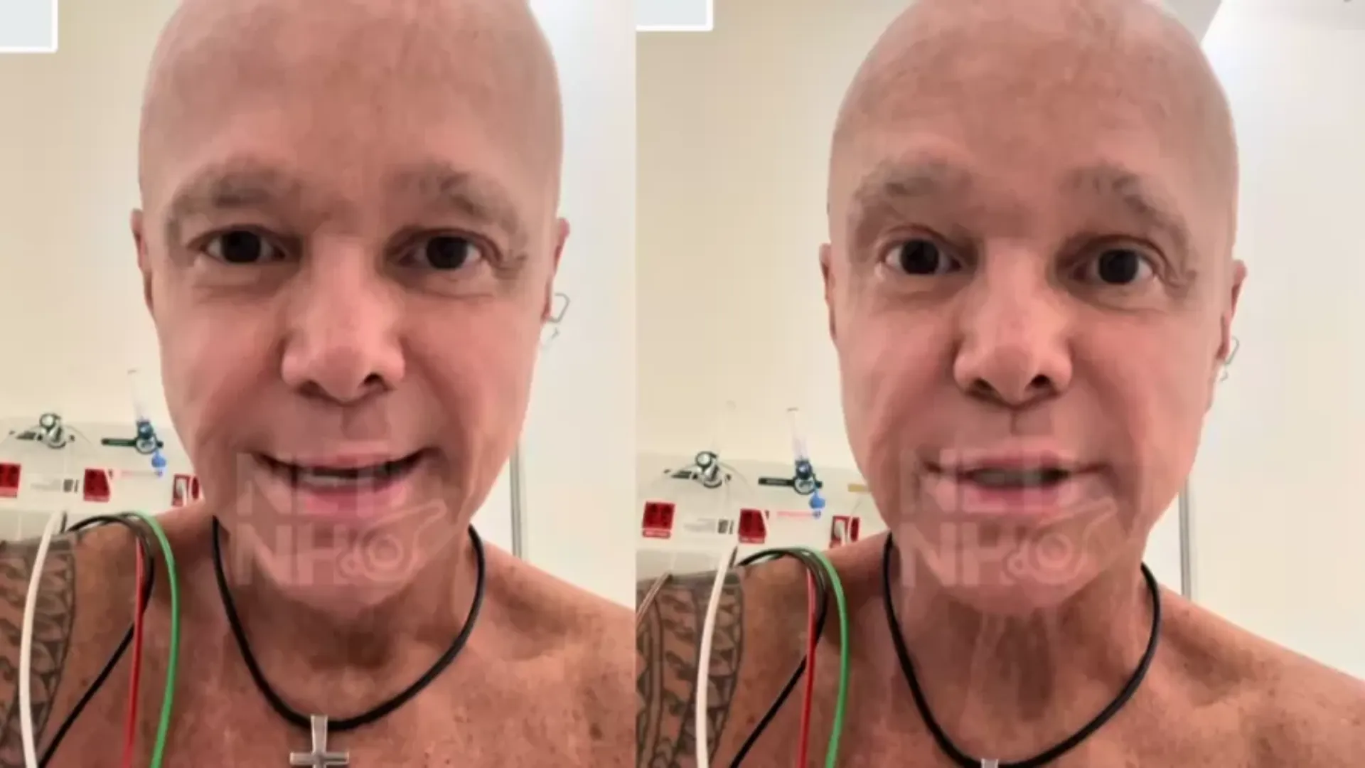 A nova internação, anunciada em setembro, marcou mais um capítulo da luta do artista contra a doença. | Foto: Redes Sociais