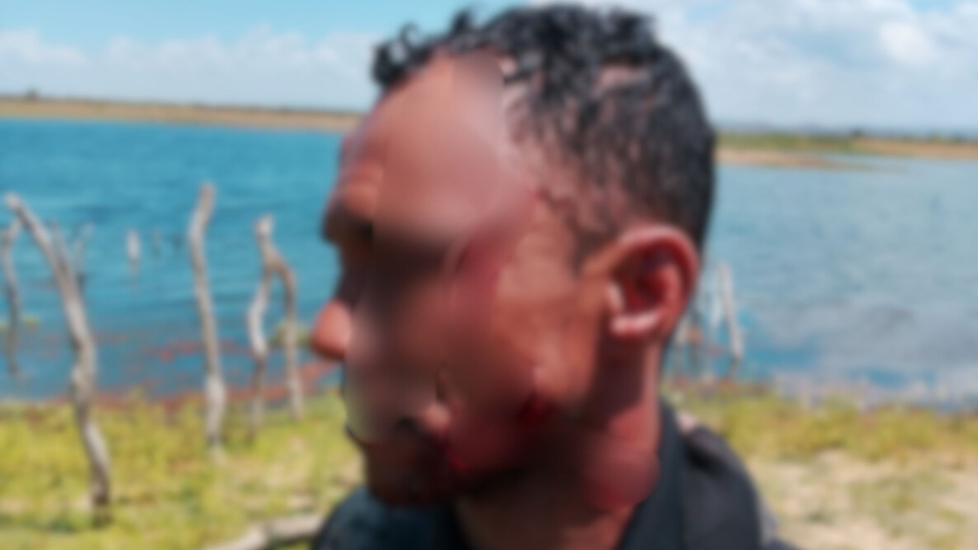 Ataque de jacaré na Bahia. Foto: Redes sociais