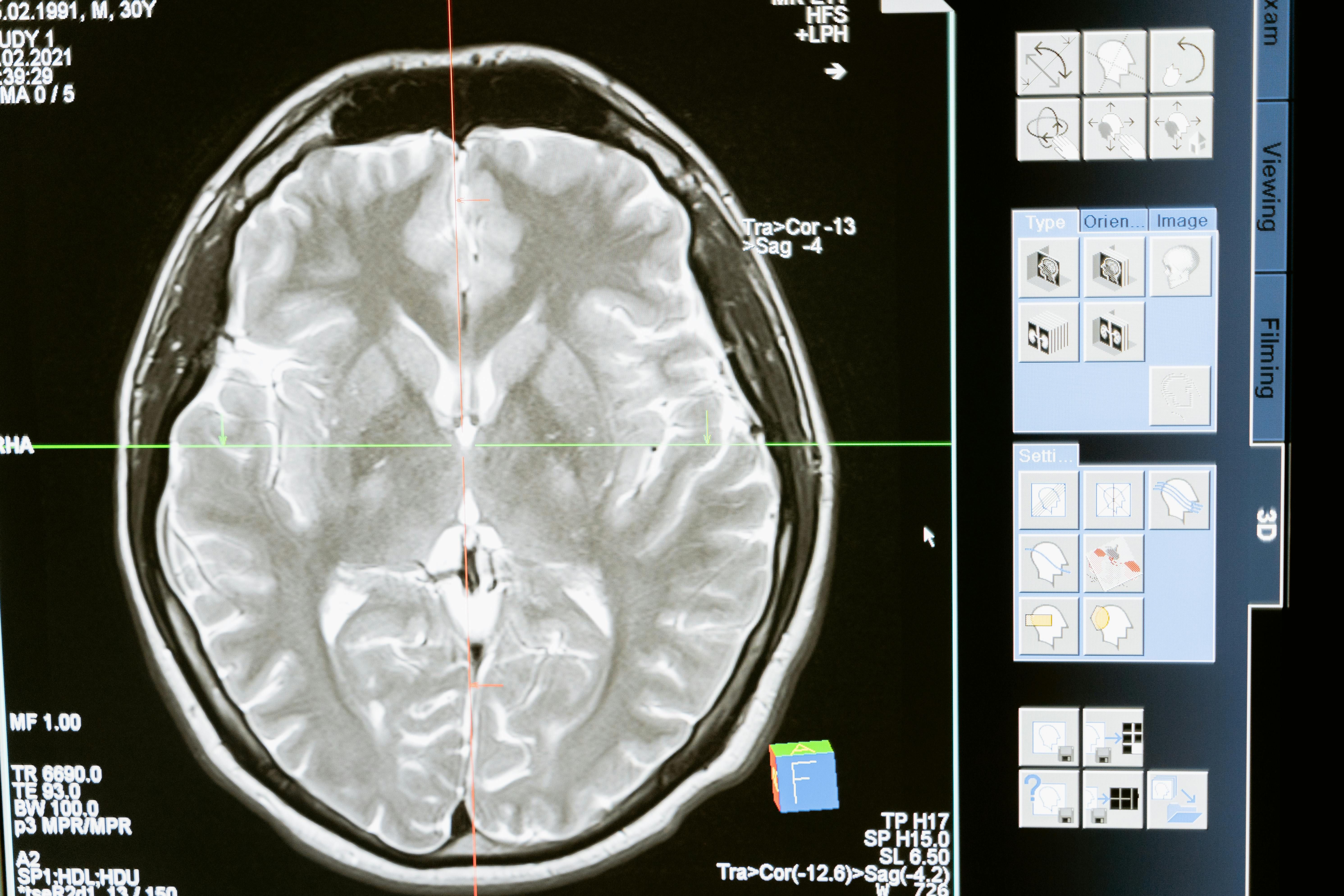  criança disse ainda que tem o objetivo de se tornar neurocirurgião pediátrico. | Foto: Ilustrativa/Pexels