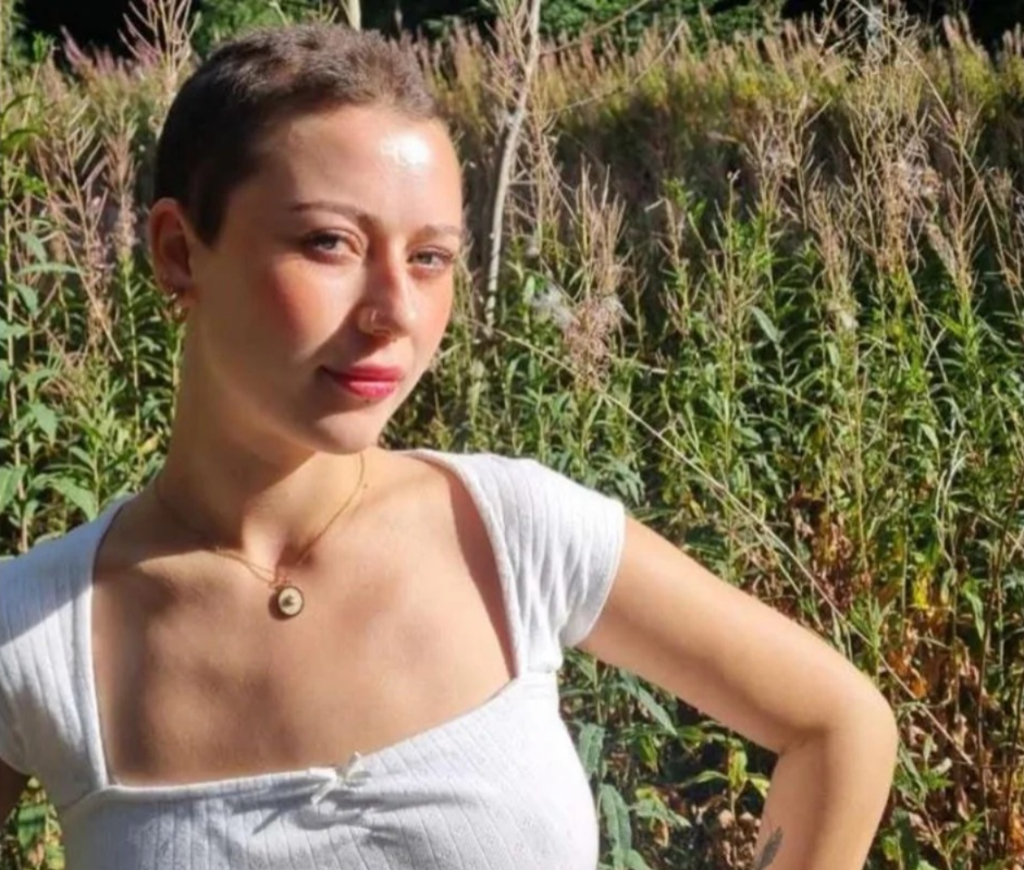 A estudante Lauren Johnson, de 23 anos, viveu uma transformação após enfrentar um período de estresse no trabalho e perder todo o cabelo em poucas semanas. | Foto: Redes Sociais