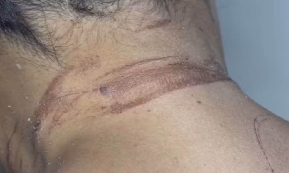Caso de mulher enterrada viva aconteceu em Itabuna | Foto: Reprodução/TV Bahia
