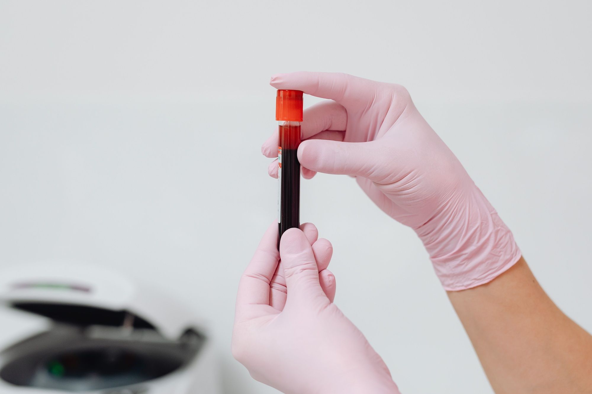 Nesse processo, os exames laboratoriais podem complementar a avaliação médica. | Foto: Ilustrativa/Pexels