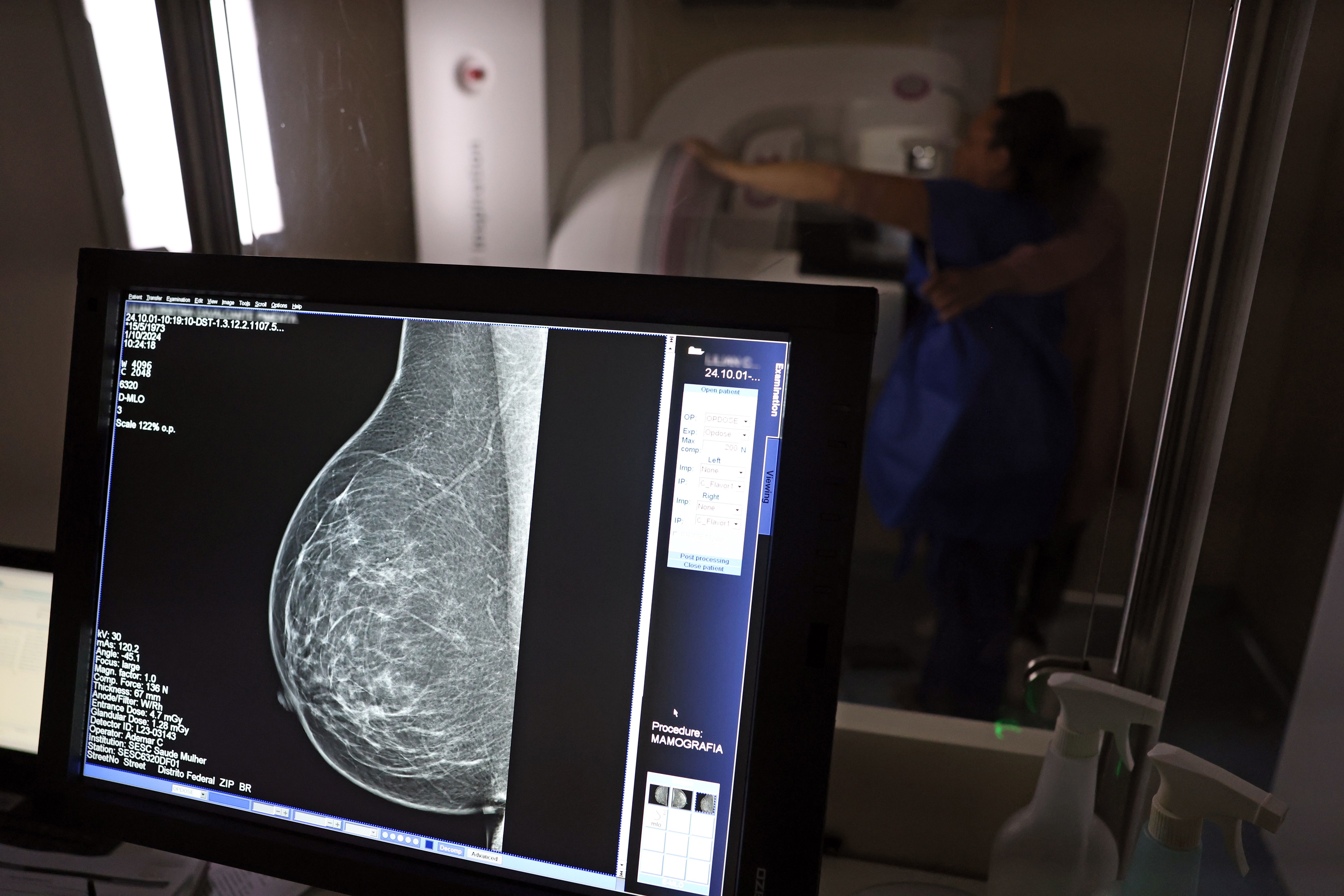 A recomenda&ccedil;&atilde;o para mamografia depende da idade, da presen&ccedil;a de sintomas e dos fatores de risco. | Foto: Jos&eacute; Cruz/Ag&ecirc;ncia Brasil